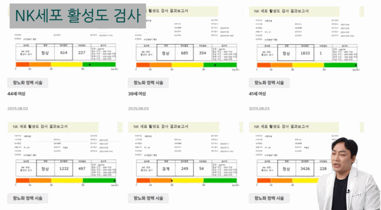 줄기세포 정맥주사 전후 NK세포 활성도 검사 결과보고서 여러 건