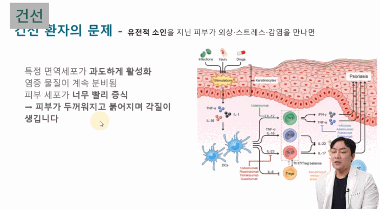 건선 자가면역질환에서 면역세포가 피부 세포를 공격하는 면역 기전을 표현한 도해