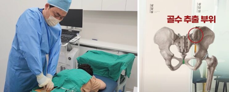 관절염줄기세포 치료 — 새론의원