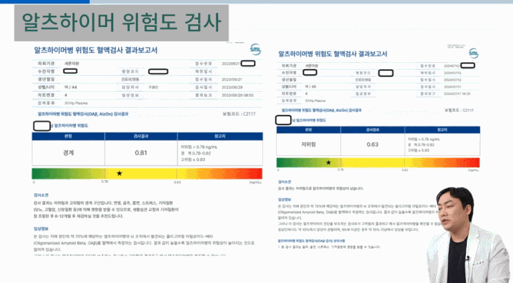 알츠하이머 위험도 혈액검사 결과보고서 — 경계 수치 0.81에서 저위험 0.63으로 개선