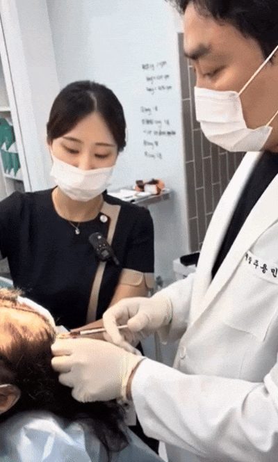 Medical staff performing a regenerative procedure on a patient's scalp