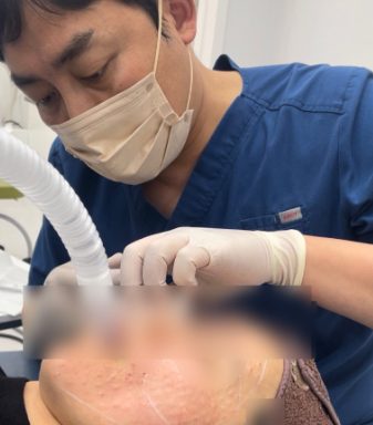 주용민 원장이 환자 얼굴에 재생 시술을 시행하는 장면