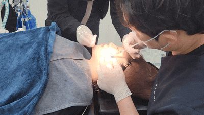 의료진이 환자 얼굴에 스킨부스터 주사를 시술하는 장면