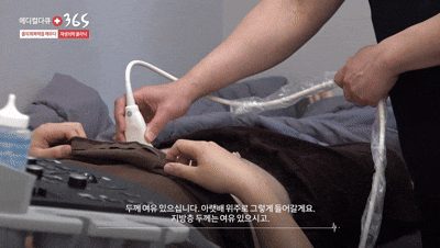 Checking the thickness of the abdominal fat layer by ultrasound to judge whether SVF harvesting is feasible
