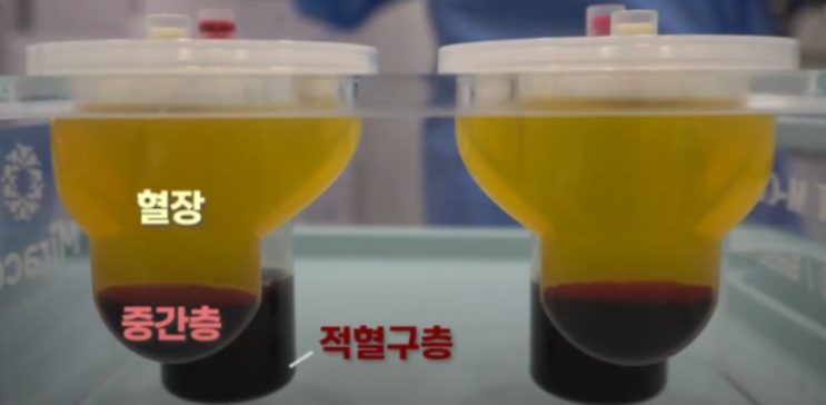 원심분리를 마친 혈액이 혈장, 중간층, 적혈구층으로 나뉜 모습을 표시한 사진