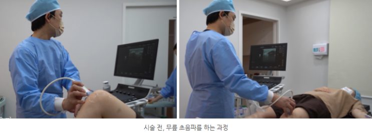 수술모와 마스크를 쓴 의료진이 진료실에서 누워 있는 환자의 무릎에 초음파 프로브를 대고 모니터를 보며 확인하는 장면 두 컷