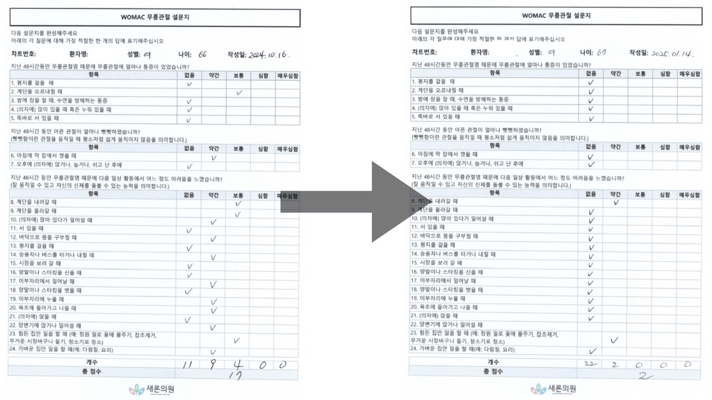 66세여성.jpg
