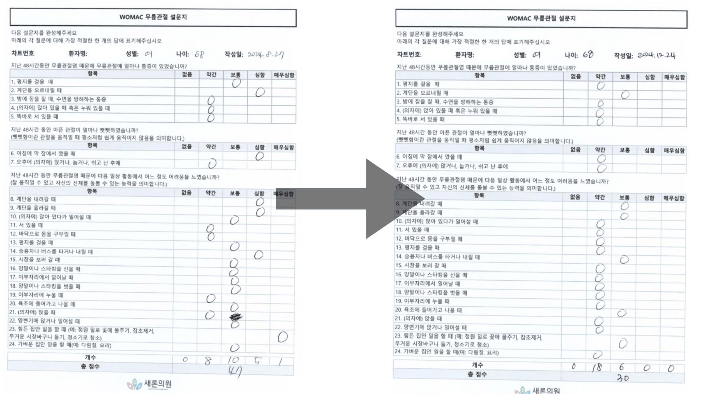 68세여성.jpg
