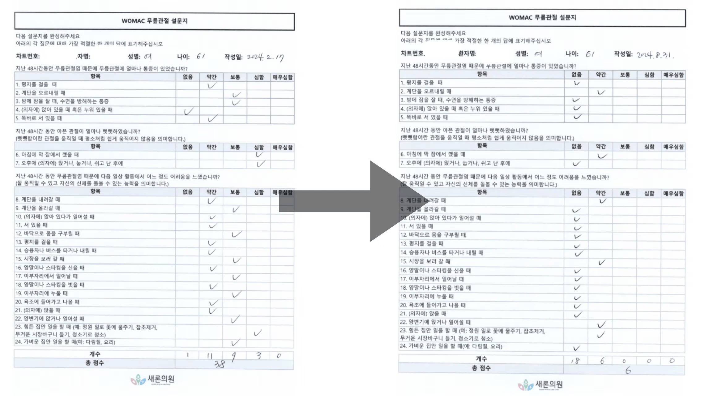 61세여성.jpg